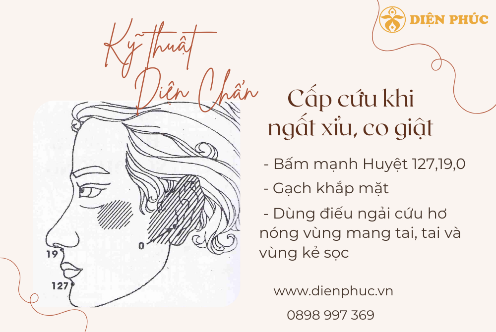 kỹ thuật Diện Chẩn cấp cứu ngất xỉu, co giật